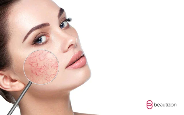skincare da nhay cam 1 7bfbb0e10557419186c4af6e8734556a