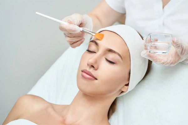 Peel da trị mụn