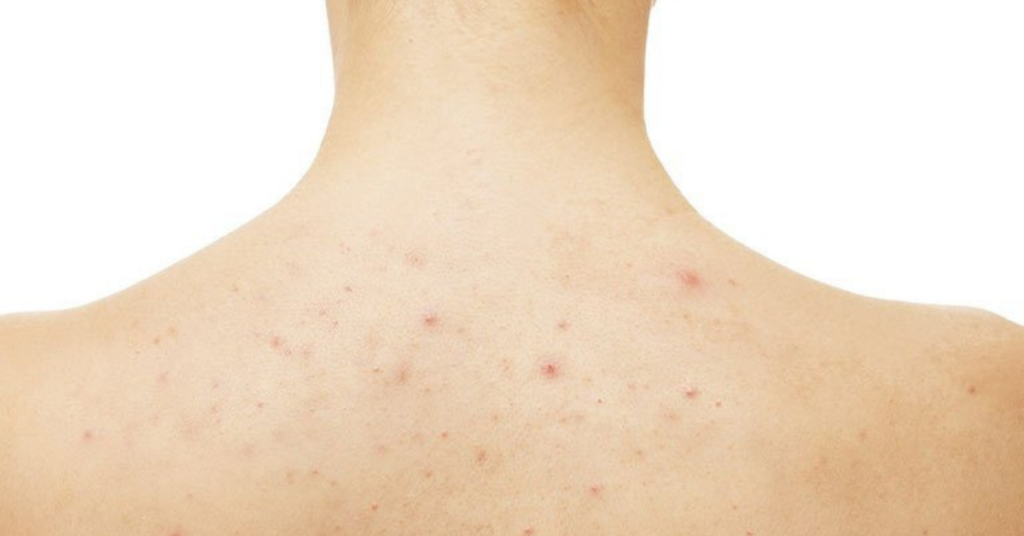 4 bước chăm sóc da toàn thân ban đêm cho làn da sáng mịn 2 chăm sóc da toàn thân