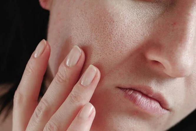 dryskin
