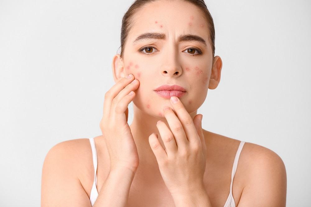 mun pimples