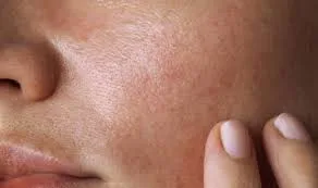 oil skin