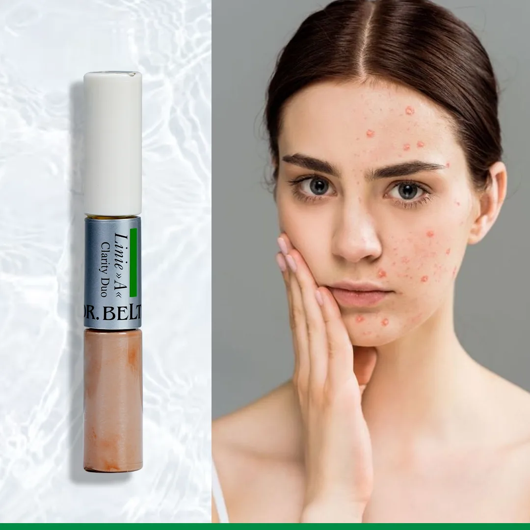 Bút chấm mụn che khuyết điểm Dr.Belter 526 Clarity Duo 2x6ml. 4 Bút chấm mụn che khuyết điểm Dr.Belter 526 Clarity Duo 2x6ml. - Ảnh 4